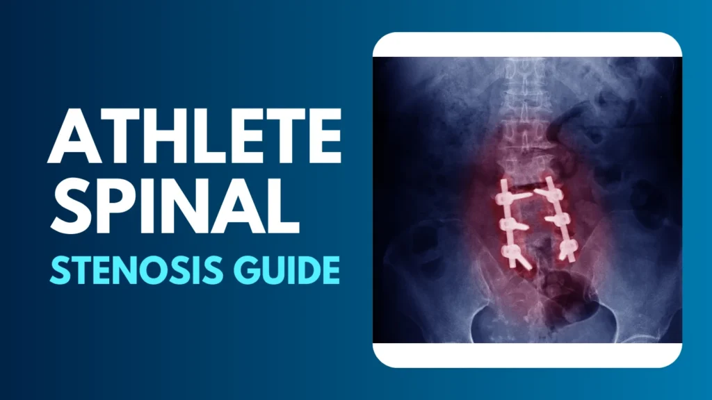 athlete spinal stenosis guide